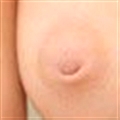 Nipples: Inverted